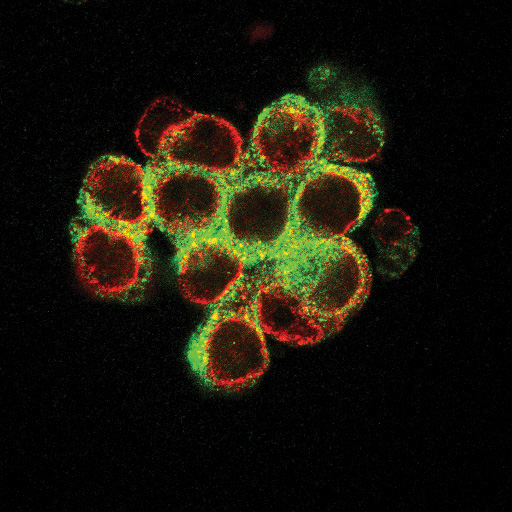 Spheroid of ovarian cancer cells growing in 3D
				Photo Credit: Jaidev Bapat